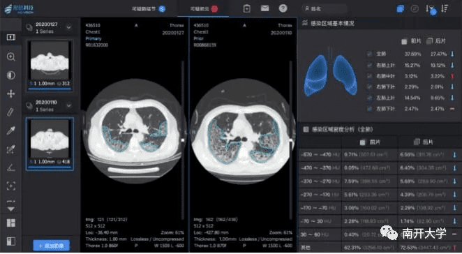 官方下载视 ar,实地验证数据计划_CT_v8.284